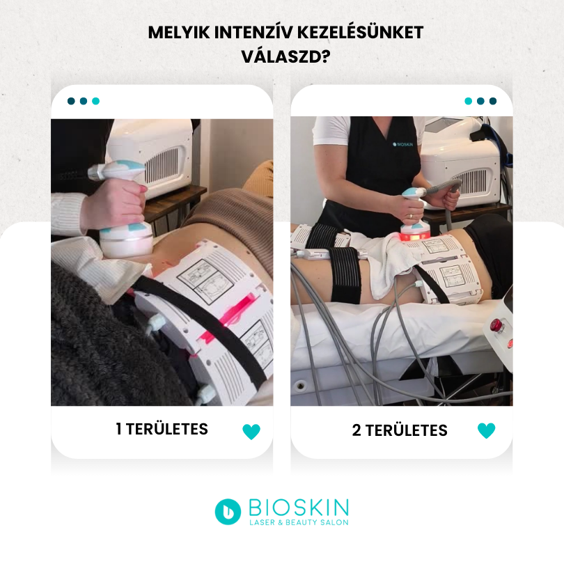 Bioskin kavitációs zsírbontás árak Székesfehérvár 13 intenziv zsirbontas szekesfehervar